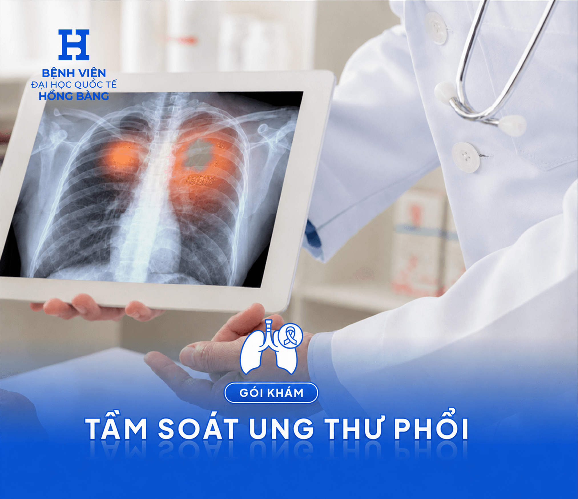 Tầm soát ung thư phổi